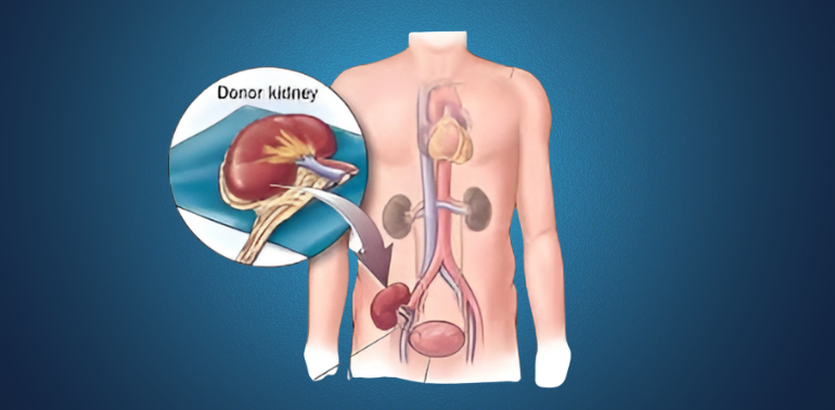 Kidney Transplant Service