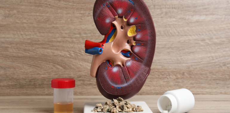 Kidney Transplant Service